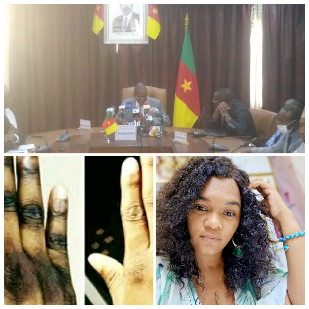 Cameroun- Promotion du "djansang": Malachie Manaouda vomit de l'Hon. Nourane Foster 1